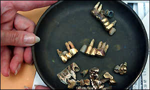 Gold teeth revoved from Jews in Nazi consentration camps. Photo from Holocaust Museum. 