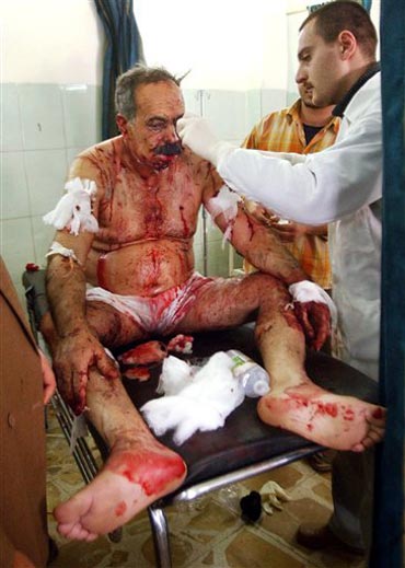 image675129 This Muslim in Baghdad survived a suicide attack from a Muslim brother