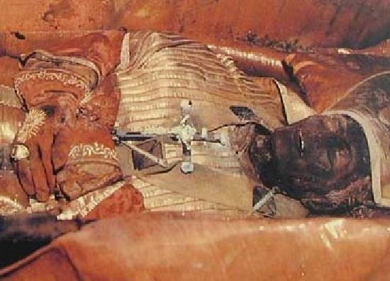 The beautification process of Pope Pius IX must have been like a nightmare for all who saw this corpse without a face mask.