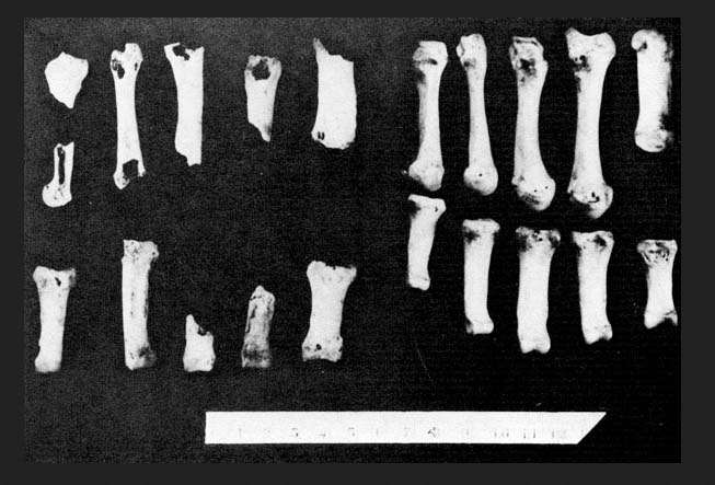 This is the collection of bones claimed to be of "Peter", soon to be venerated by Catholics. 
