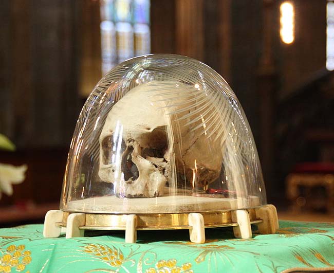 The claimed to be "holy" skull of Saint Adalbert of Prague. 