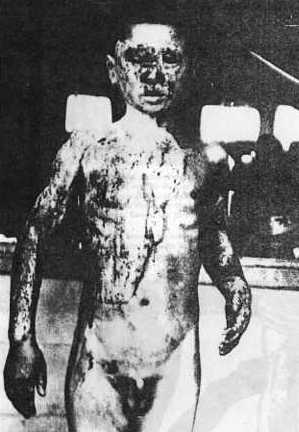 Hiroshima. Man is his own worst enemy, as long as Satan reigns in his heart. 